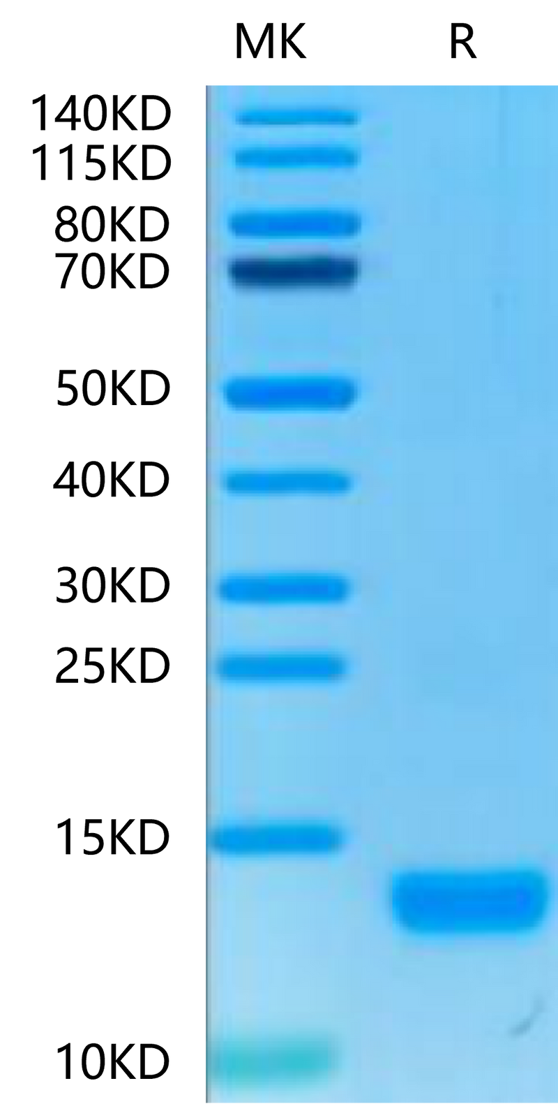 Human CXCL4 on Tris-Bis PAGE under reduced condition. The purity is greater than 95%.Recombinant Human CXCL4 Protein