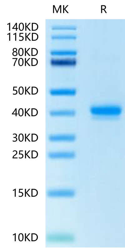 Human IGFI on Tris-Bis PAGE under reduced condition. The purity is greater than 95%.Recombinant Human IGFI Protein, Active