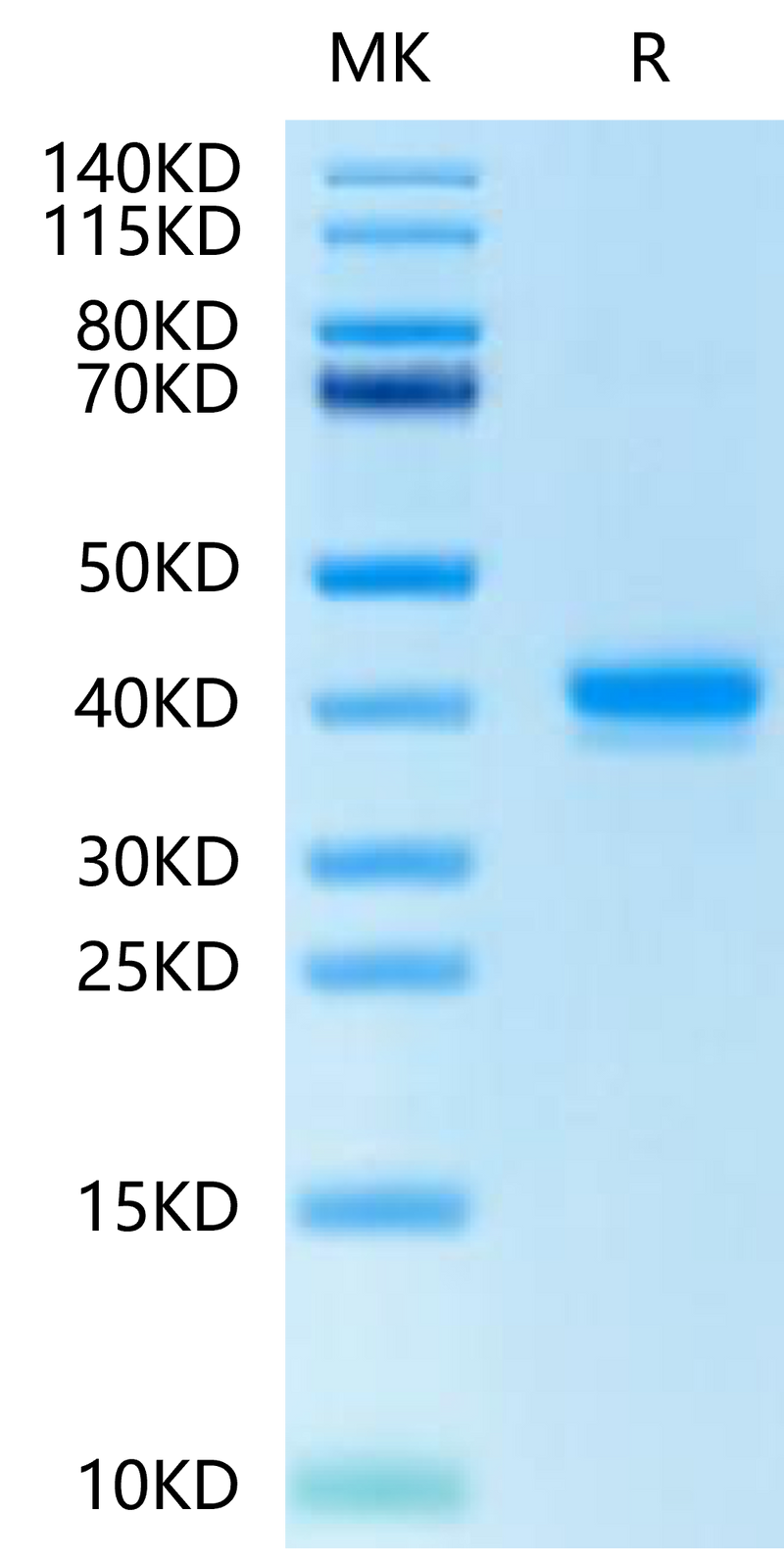 Human IGFI on Tris-Bis PAGE under reduced condition. The purity is greater than 95%.Recombinant Human IGFI Protein, Active
