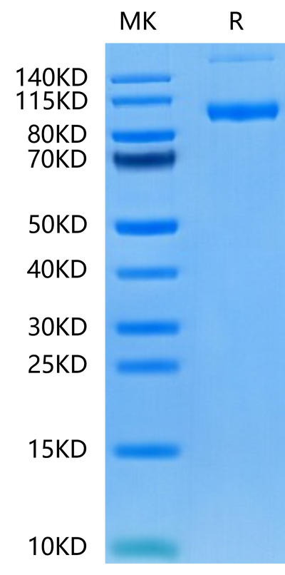 Human PSMA on Tris-Bis PAGE under reduced condition. The purity is greater than 95%.Recombinant Human PSMA/FOLH1 Protein, Active