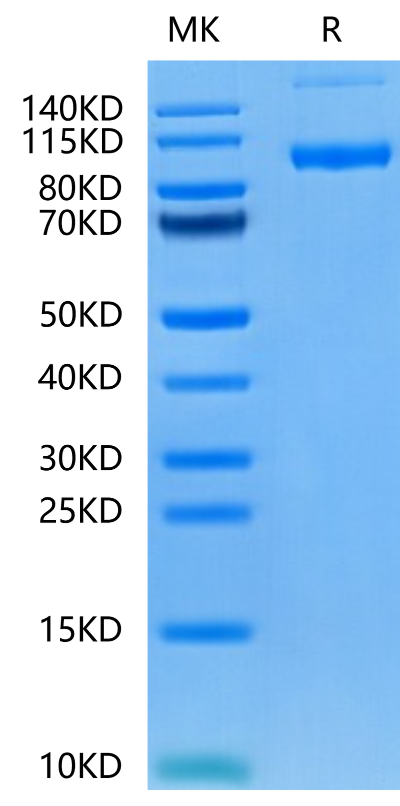 Human PSMA on Tris-Bis PAGE under reduced condition. The purity is greater than 95%.Recombinant Human PSMA/FOLH1 Protein, Active