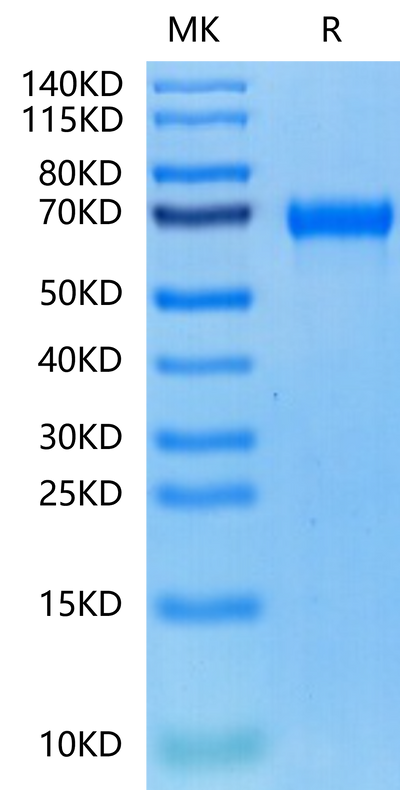 Cynomolgus MMP-8 on Tris-Bis PAGE under reduced condition. The purity is greater than 95%.Recombinant Cynomolgus MMP-8 Protein, Active