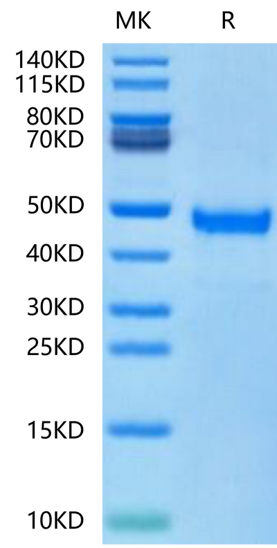 Human DKK1 N terminal Domain on Tris-Bis PAGE under reduced condition. The purity is greater than 95%.Recombinant Human DKK1 N terminal Domain Protein