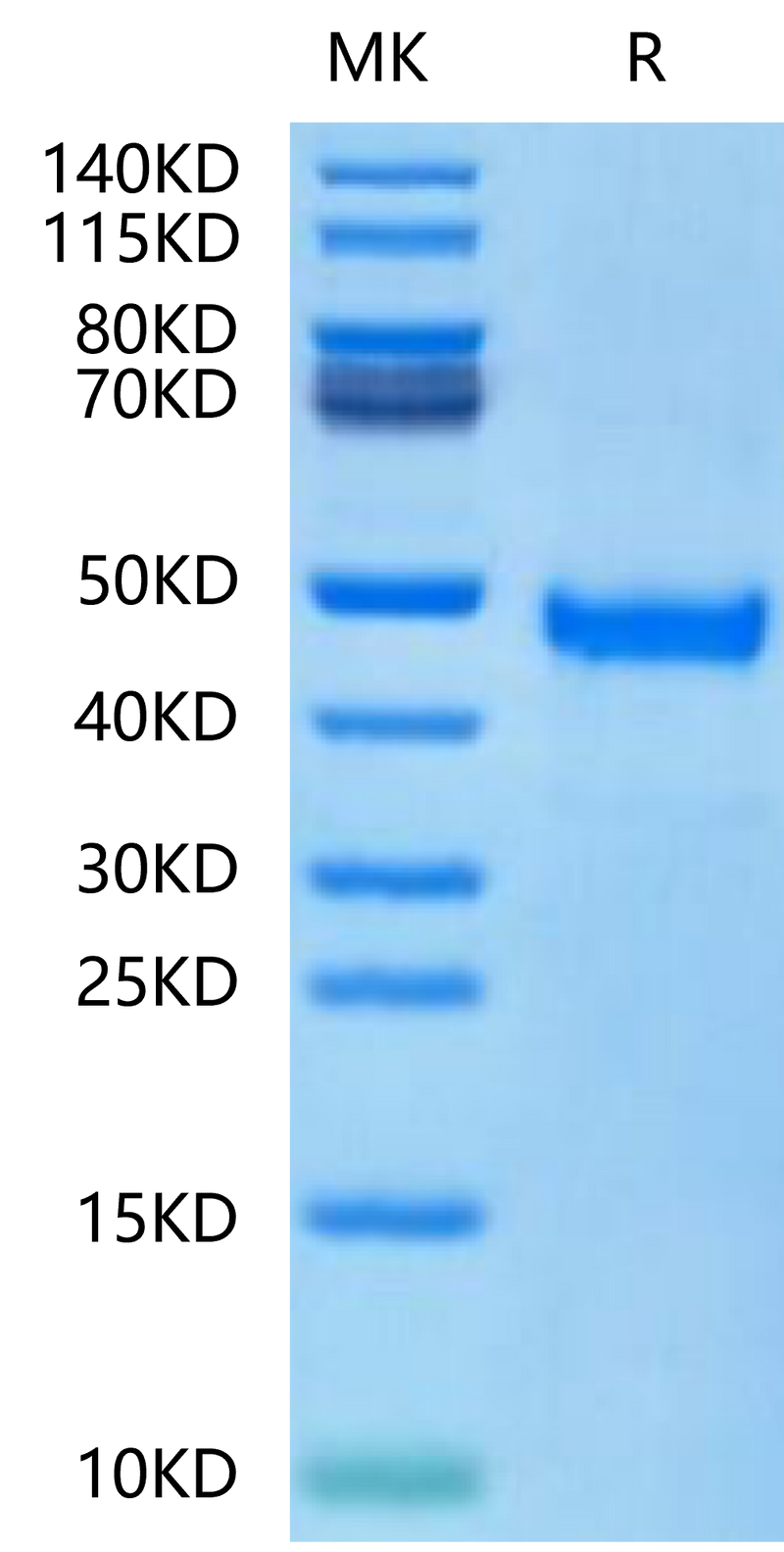 Human DKK1 N terminal Domain on Tris-Bis PAGE under reduced condition. The purity is greater than 95%.Recombinant Human DKK1 N terminal Domain Protein