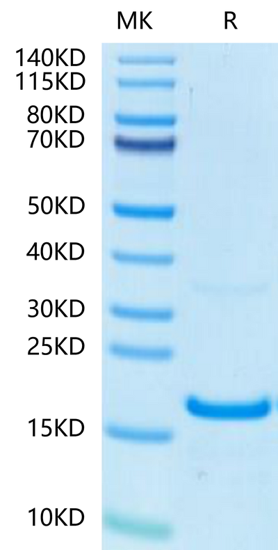 Human IFN gamma on Tris-Bis PAGE under reduced condition. The purity is greater than 95%.Recombinant Human IFN gamma/IFNG Protein, Active