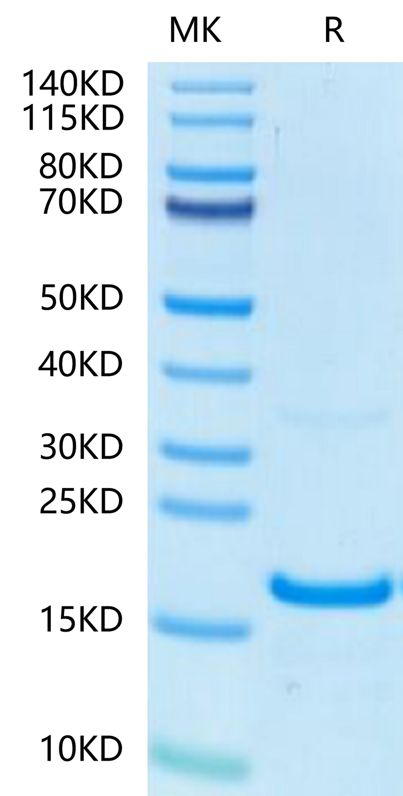 Human IFN gamma on Tris-Bis PAGE under reduced condition. The purity is greater than 95%.Recombinant Human IFN gamma/IFNG Protein, Active