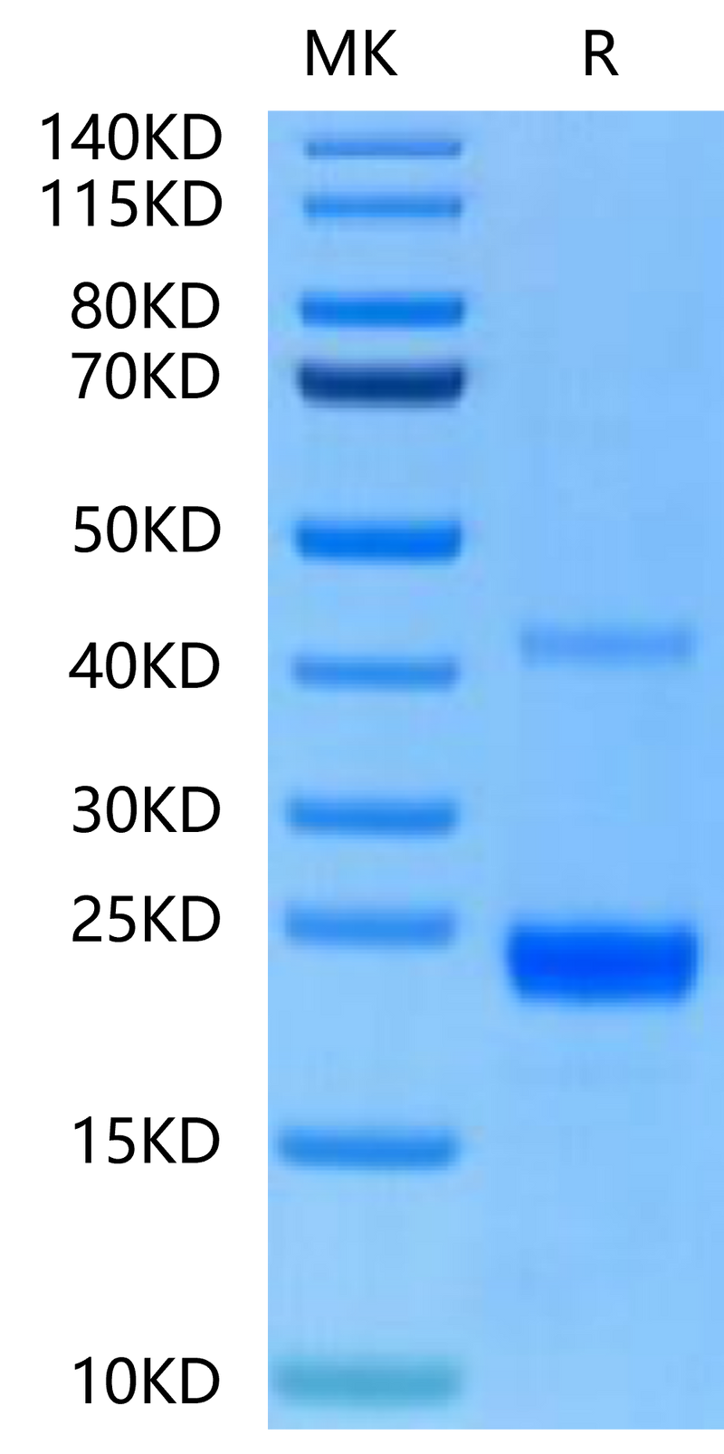 Mouse CD40 Ligand on Tris-Bis PAGE under reduced condition. The purity is greater than 95%.Recombinant Mouse CD40 Ligand/TNFSF5 Protein, Active