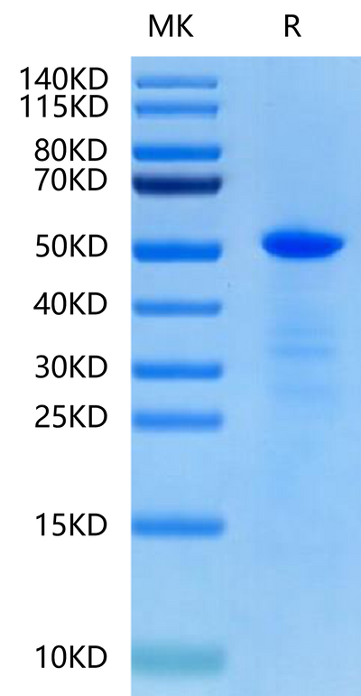 Human CHRDL1 on Tris-Bis PAGE under reduced condition. The purity is greater than 90%.Recombinant Human CHRDL1 Protein, Active