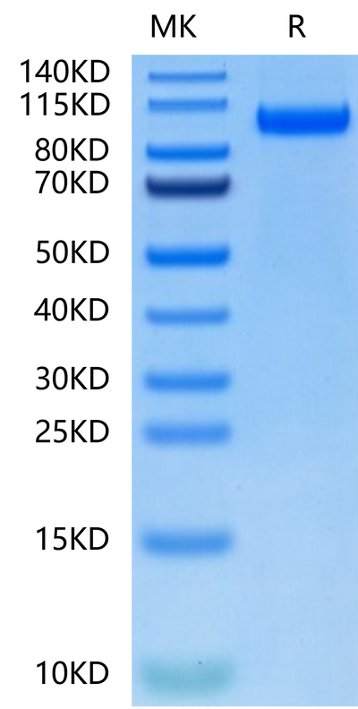 Biotinylated Human CDCP1 on Tris-Bis PAGE under reduced condition. The purity is greater than 95%.Biotinylated Human CDCP1 Protein, Active