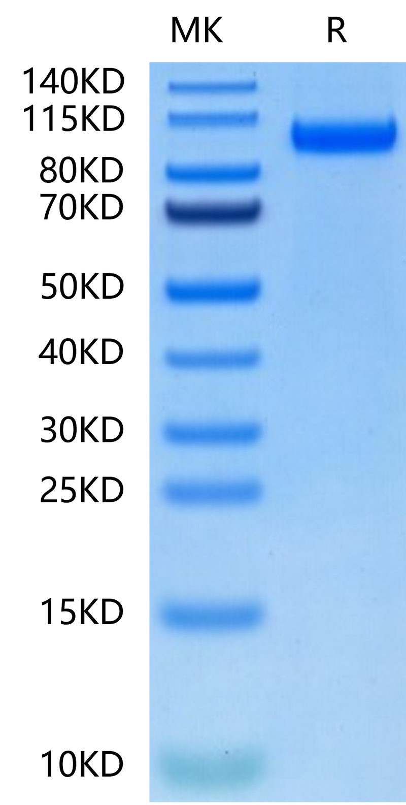 Biotinylated Human CDCP1 on Tris-Bis PAGE under reduced condition. The purity is greater than 95%.Biotinylated Human CDCP1 Protein, Active