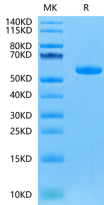 Human FGF21 on Tris-Bis PAGE under reduced condition. The purity is greater than 95%.Recombinant Human FGF21 Protein, Active