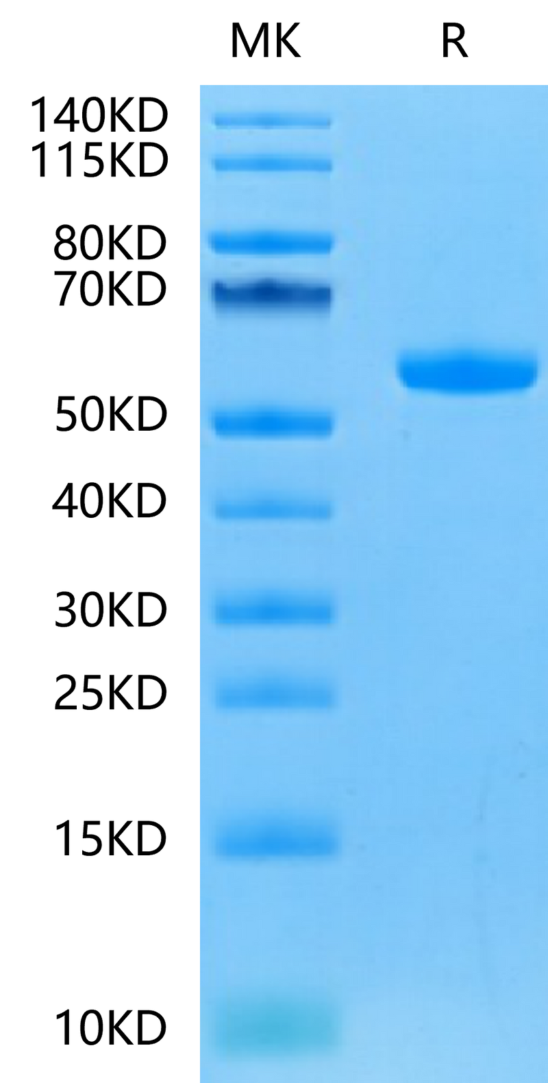 Human FGF21 on Tris-Bis PAGE under reduced condition. The purity is greater than 95%.Recombinant Human FGF21 Protein, Active