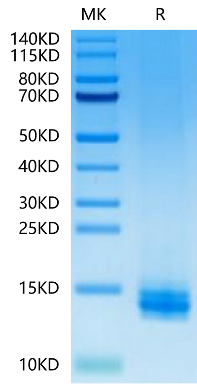 Human LILRB4 Domain 1 on Tris-Bis PAGE under reduced condition. The purity is greater than 95%.Recombinant Human LILRB4/CD85k/ILT3 Domain 1 Protein