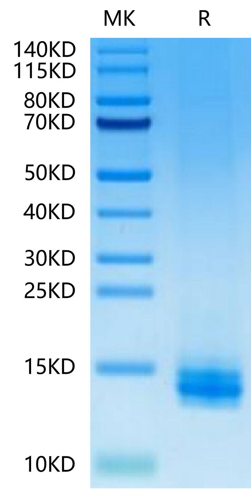 Human LILRB4 Domain 1 on Tris-Bis PAGE under reduced condition. The purity is greater than 95%.Recombinant Human LILRB4/CD85k/ILT3 Domain 1 Protein