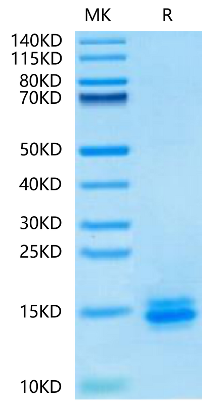 Biotinylated Human LILRB4 Domain 1 on Tris-Bis PAGE under reduced condition. The purity is greater than 95%.Biotinylated Human LILRB4/CD85k/ILT3 Domain 1 Protein