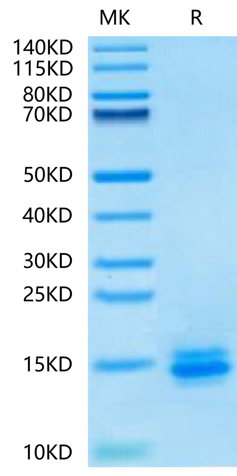Biotinylated Human LILRB4 Domain 1 on Tris-Bis PAGE under reduced condition. The purity is greater than 95%.Biotinylated Human LILRB4/CD85k/ILT3 Domain 1 Protein