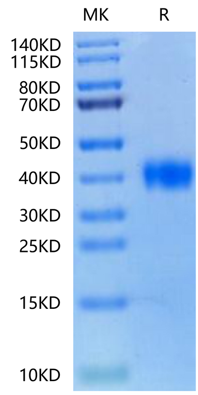 Biotinylated SARS RBD on Tris-Bis PAGE under reduced condition. The purity is greater than 95%.Biotinylated SARS Spike RBD Protein, Active