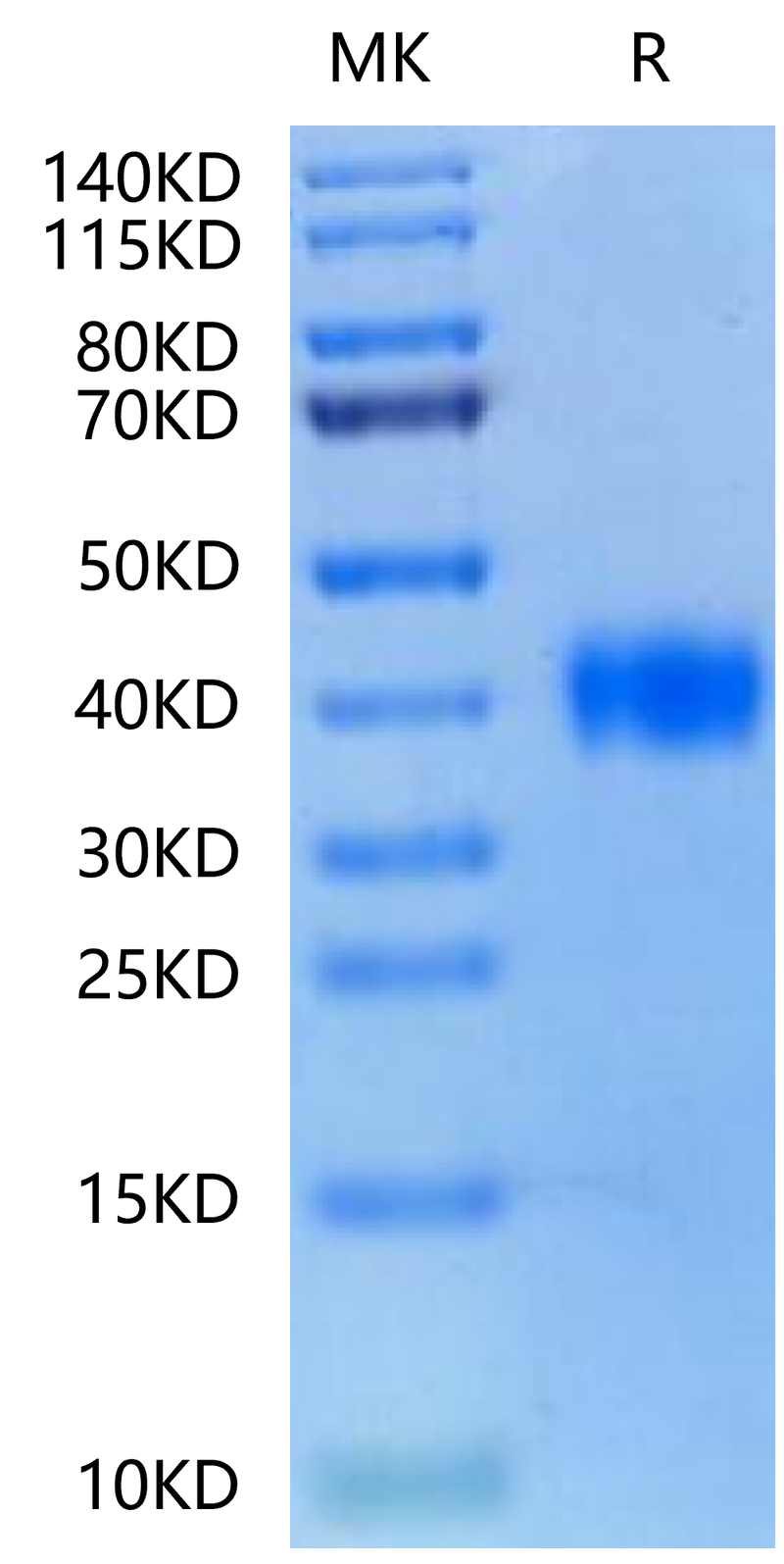 Biotinylated SARS RBD on Tris-Bis PAGE under reduced condition. The purity is greater than 95%.Biotinylated SARS Spike RBD Protein, Active