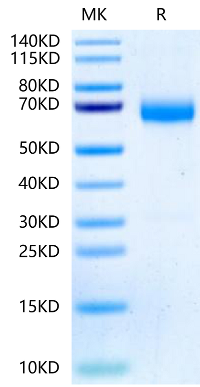 Human ANGPTL3 on Tris-Bis PAGE under reduced condition. The purity is greater than 95%.Recombinant Human ANGPTL3/Angiopoietin-like 3 Protein, Active