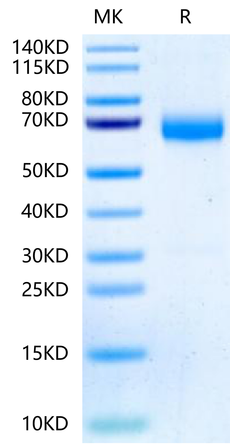 Human ANGPTL3 on Tris-Bis PAGE under reduced condition. The purity is greater than 95%.Recombinant Human ANGPTL3/Angiopoietin-like 3 Protein, Active