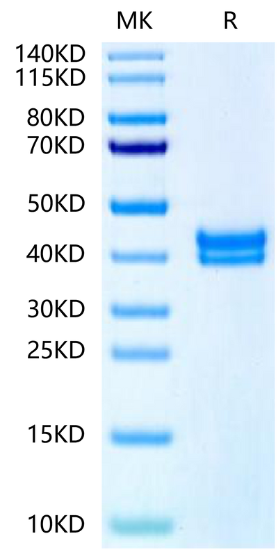 Biotinylated Human GPA33 on Tris-Bis PAGE under reduced condition. The purity is greater than 95%.Biotinylated Human GPA33/A33 Protein, Active