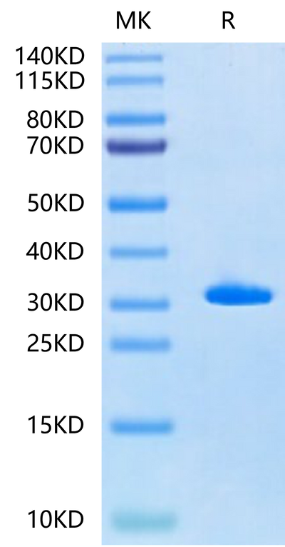 Human Latexin-on Tris-Bis PAGE under reduced condition. The purity is greater than 95%.Recombinant Human Latexin-Protein