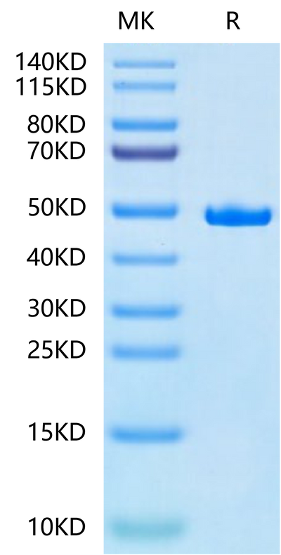 Human SETD7 on Tris-Bis PAGE under reduced condition. The purity is greater than 95%.Recombinant Human SETD7-Protein