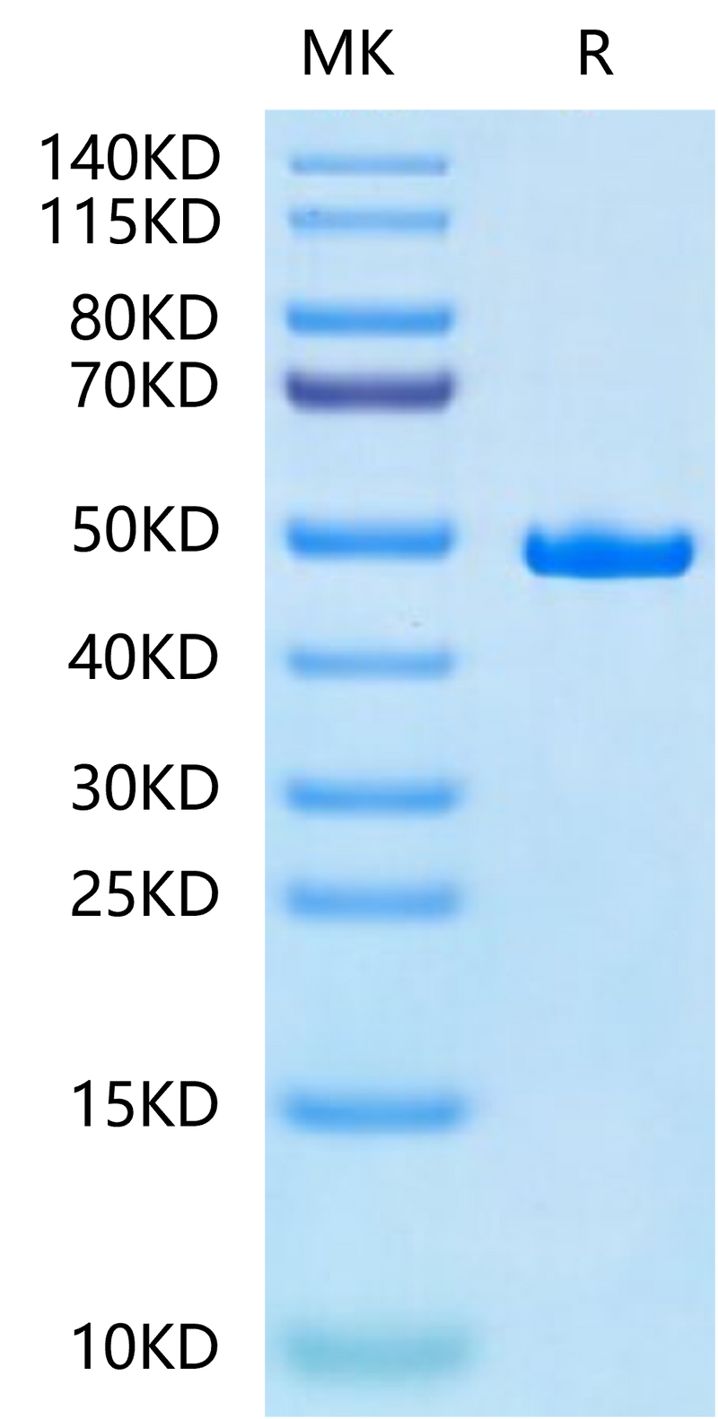 Human SETD7 on Tris-Bis PAGE under reduced condition. The purity is greater than 95%.Recombinant Human SETD7-Protein