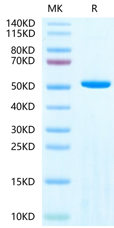 Human Adenylosuccinate Lyase-on Tris-Bis PAGE under reduced condition. The purity is greater than 95%.Recombinant Human Adenylosuccinate Lyase-Protein