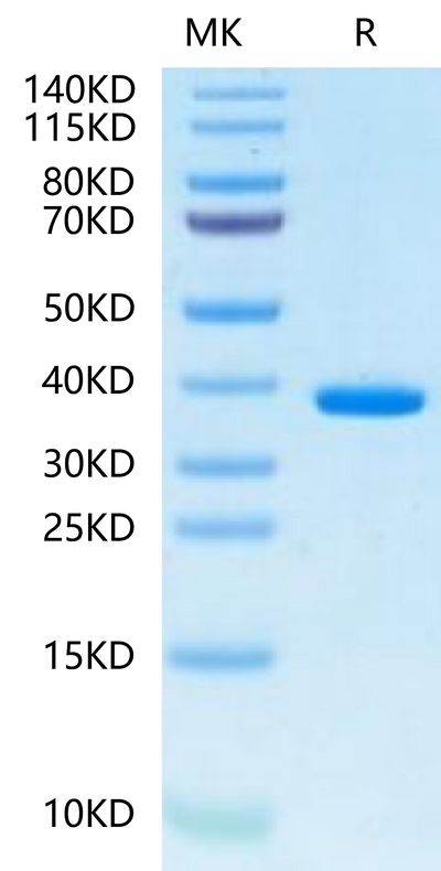 Human FDPS on Tris-Bis PAGE under reduced condition. The purity is greater than 95%.Recombinant Human FDPS-Protein