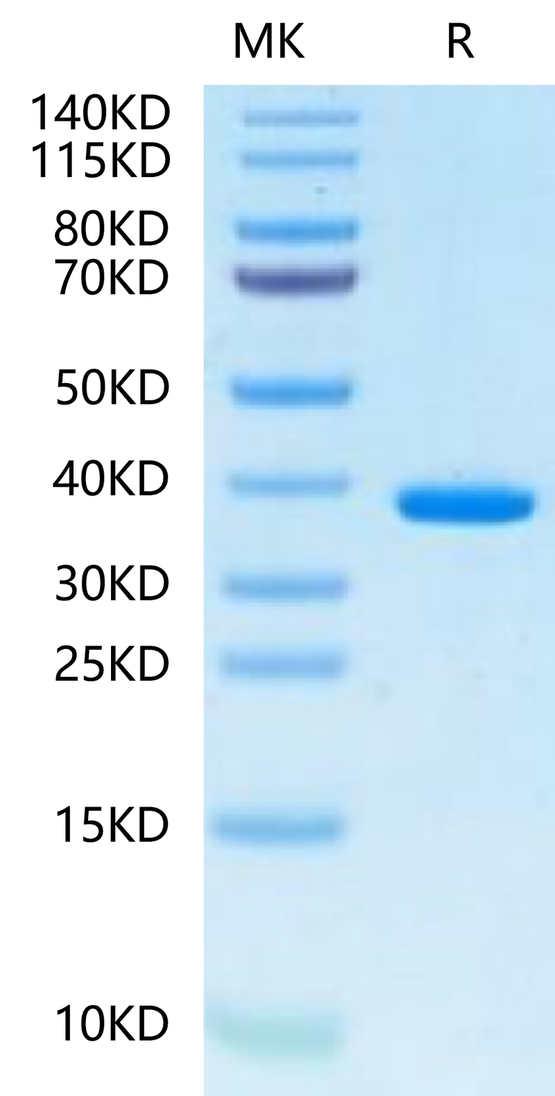 Human FDPS on Tris-Bis PAGE under reduced condition. The purity is greater than 95%.Recombinant Human FDPS-Protein