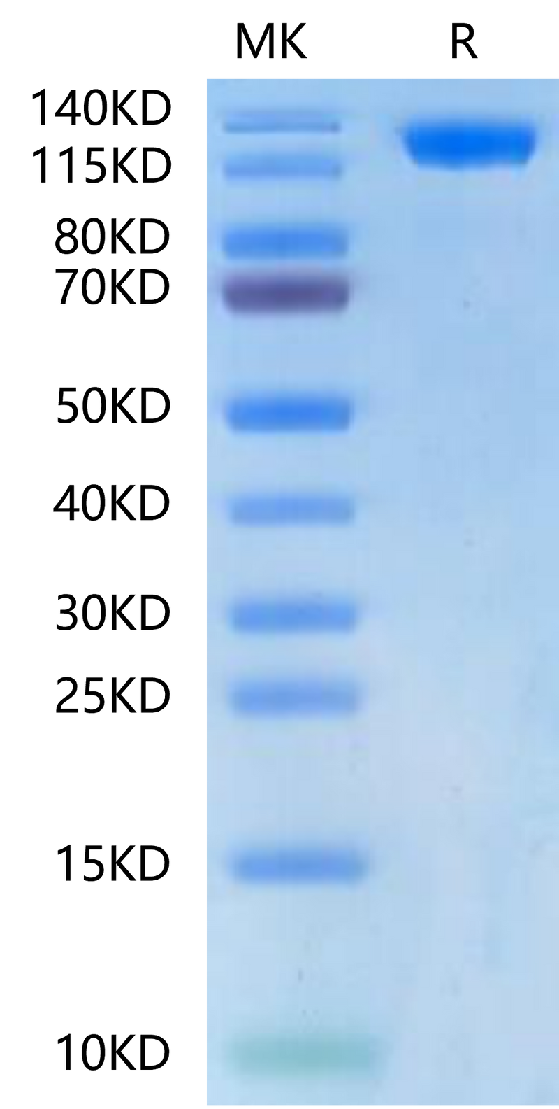 Biotinylated Human ACE2 on Tris-Bis PAGE under reduced condition. The purity is greater than 95%.Biotinylated Human ACE2/ACEH Protein, Active