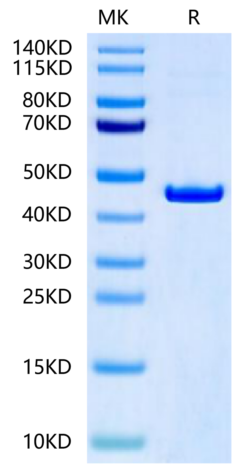 Rat CKMT2 on Tris-Bis PAGE under reduced condition. The purity is greater than 95%.Recombinant Rat CKMT2-Protein