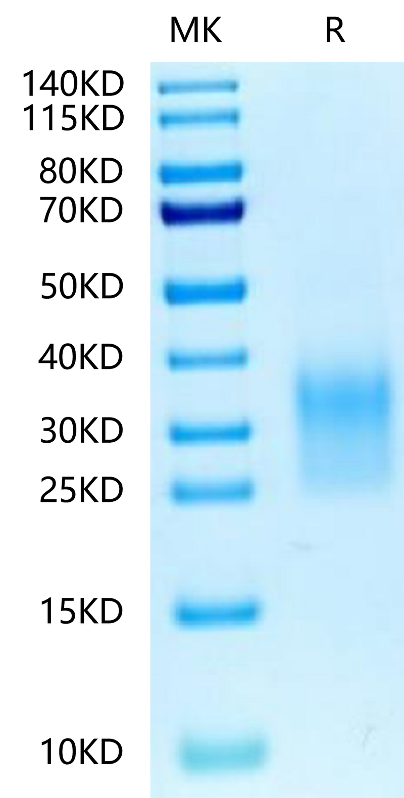 Biotinylated Human CD24 on Tris-Bis PAGE under reduced condition. The purity is greater than 95%.Biotinylated Human CD24 Protein, Active