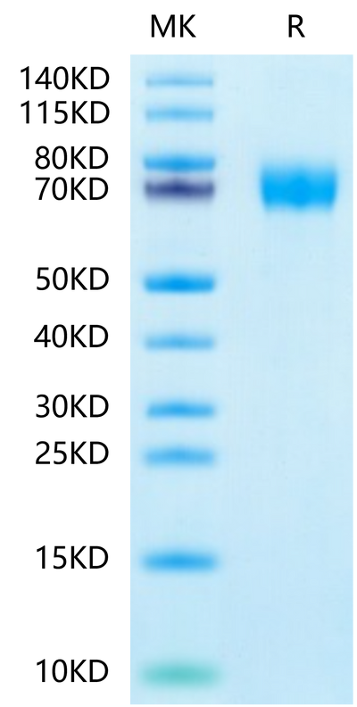 Human CLEC12A on Tris-Bis PAGE under reduced condition. The purity is greater than 95%.Recombinant Human CLEC12A/MICL/CLL-1 Protein, Active