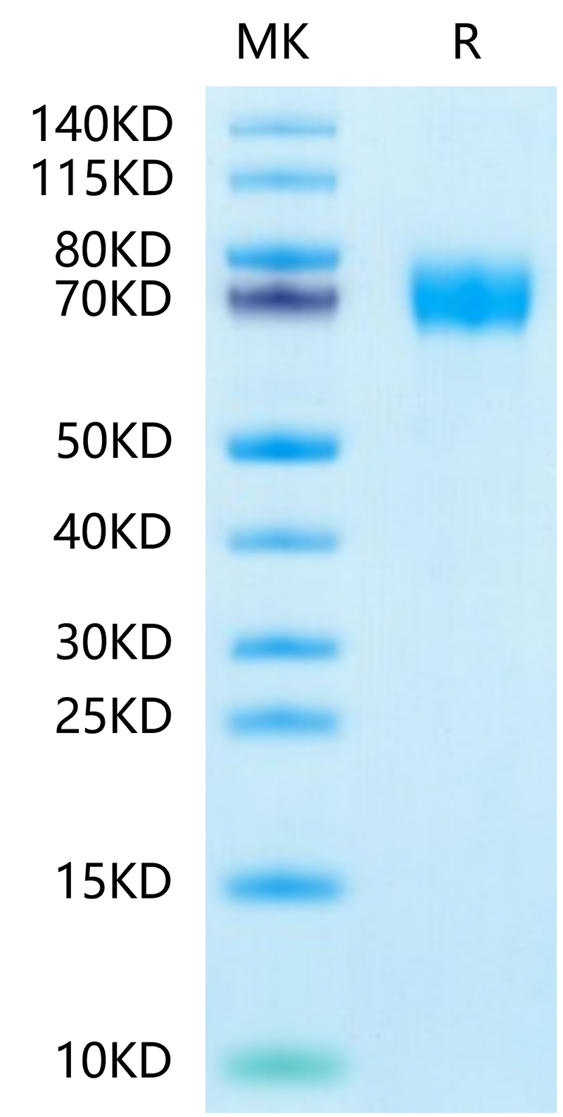 Human CLEC12A on Tris-Bis PAGE under reduced condition. The purity is greater than 95%.Recombinant Human CLEC12A/MICL/CLL-1 Protein, Active