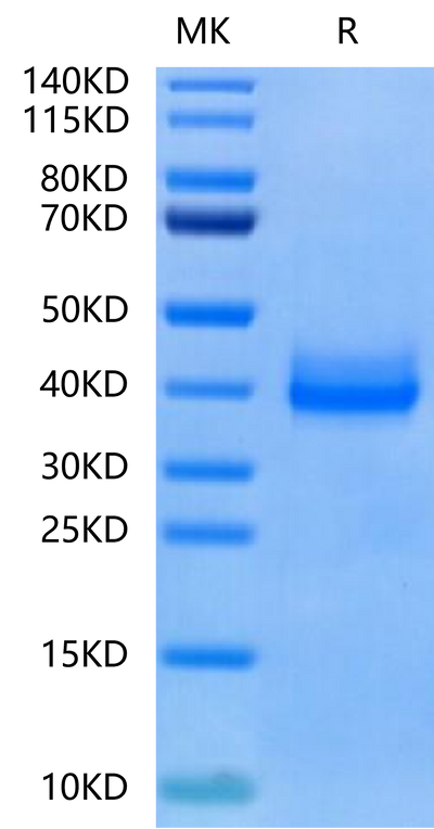 Rat IL-22R alpha 1 on Tris-Bis PAGE under reduced condition. The purity is greater than 95%.Recombinant Rat IL-22R alpha 1 Protein, Active