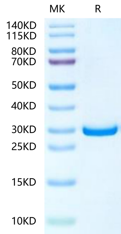 Human PHOSPHO1 on Tris-Bis PAGE under reduced condition. The purity is greater than 95%.Recombinant Human PHOSPHO1-Protein