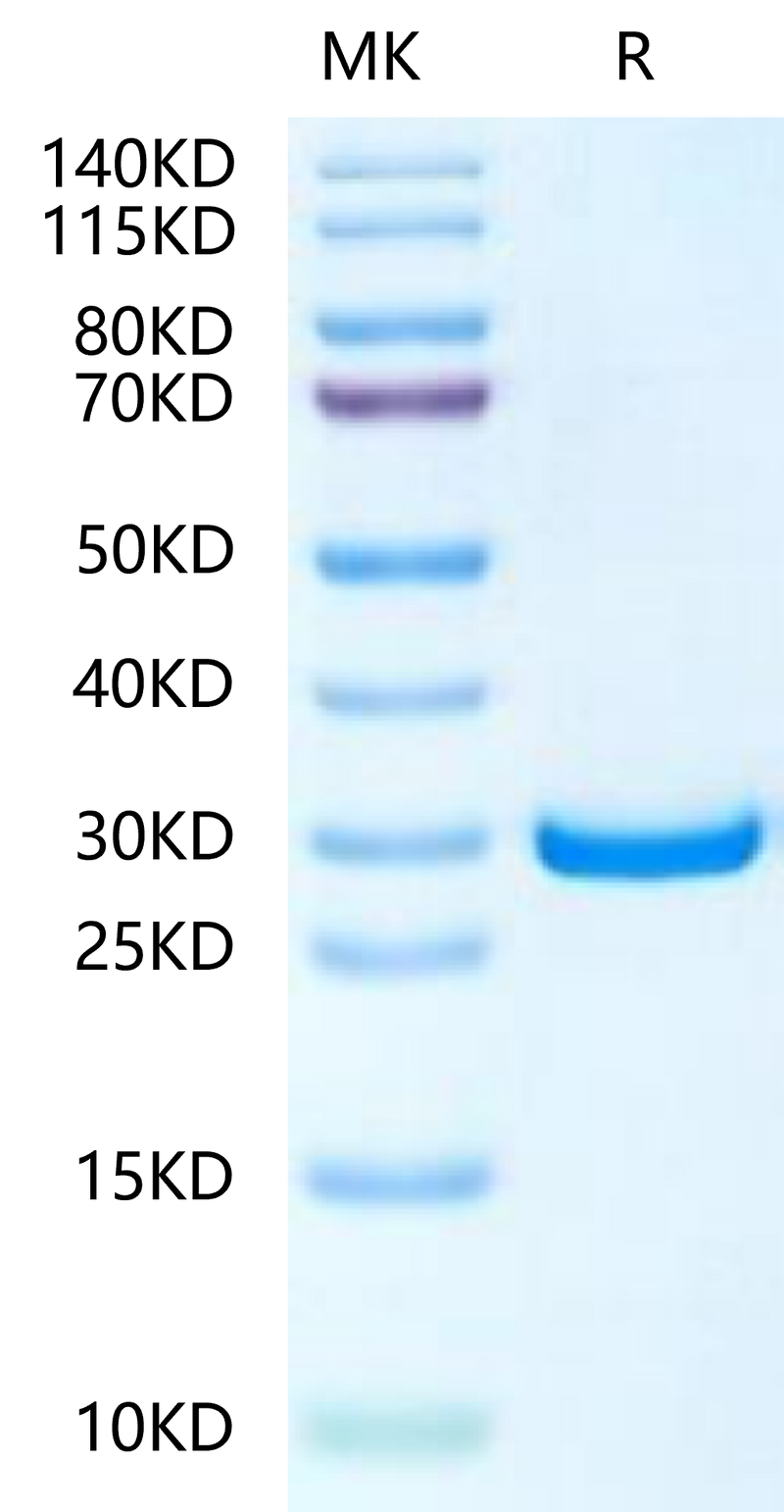 Human PHOSPHO1 on Tris-Bis PAGE under reduced condition. The purity is greater than 95%.Recombinant Human PHOSPHO1-Protein
