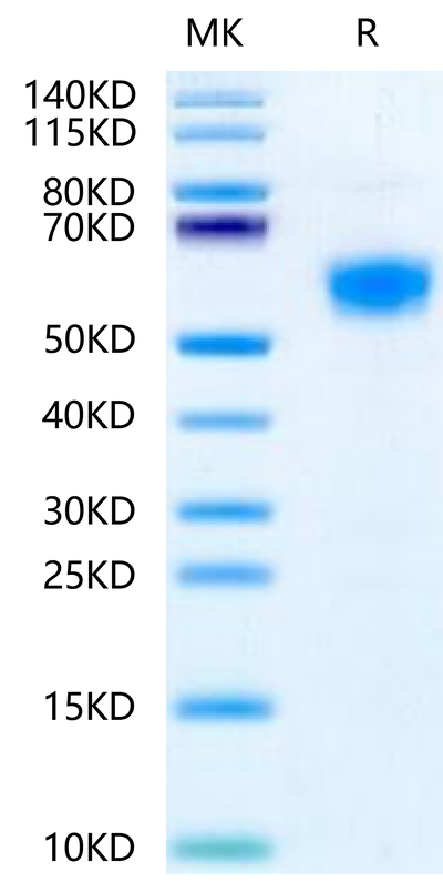 Mouse IL-18RAP on Tris-Bis PAGE under reduced condition. The purity is greater than 95%.Recombinant Mouse IL-18RAP Protein