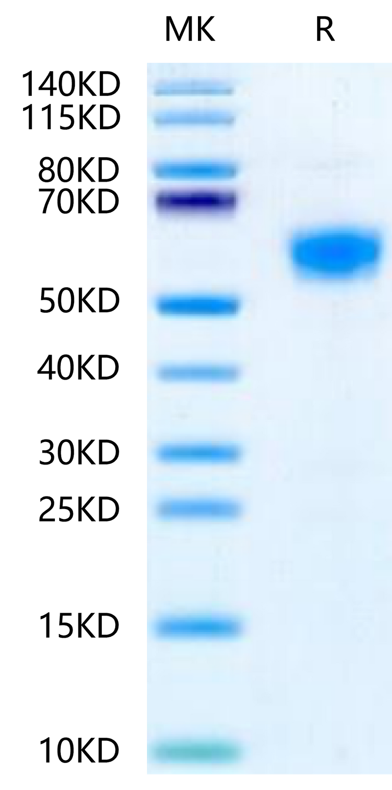 Mouse IL-18RAP on Tris-Bis PAGE under reduced condition. The purity is greater than 95%.Recombinant Mouse IL-18RAP Protein