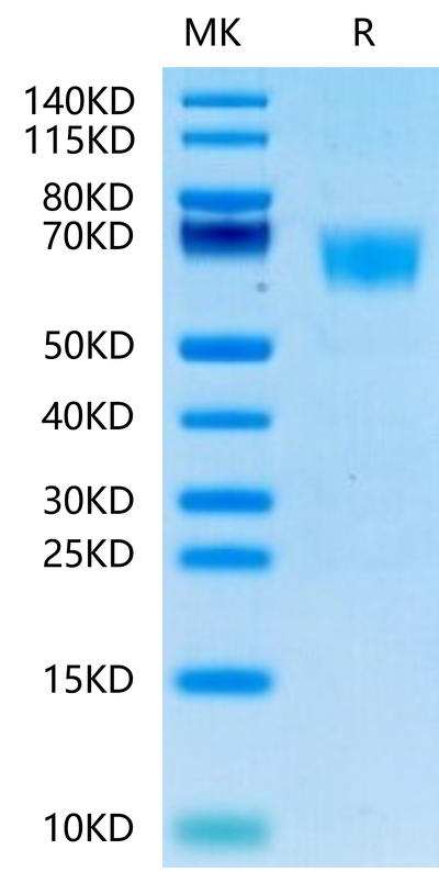 Human FGFR3 alpha (IIIc) on Tris-Bis PAGE under reduced conditions. The purity is greater than 95%.Recombinant Human FGFR3 alpha (IIIc) Protein, Active
