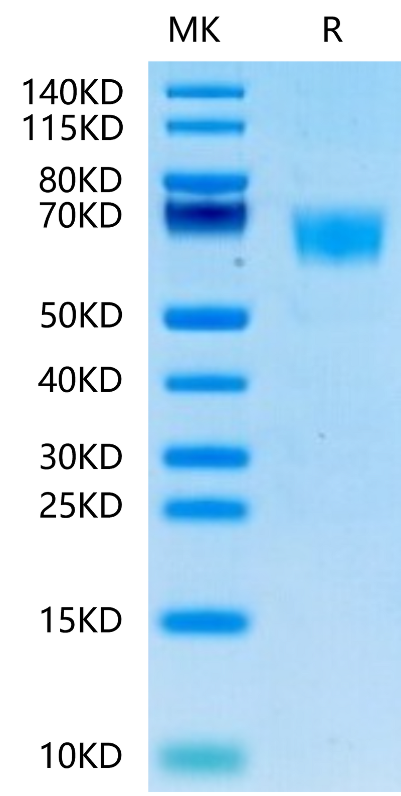Human FGFR3 alpha (IIIc) on Tris-Bis PAGE under reduced conditions. The purity is greater than 95%.Recombinant Human FGFR3 alpha (IIIc) Protein, Active