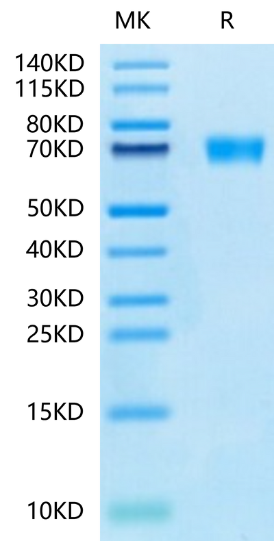 Mouse AXL on Tris-Bis PAGE under reduced condition. The purity is greater than 95%.Recombinant Mouse AXL Protein, Active