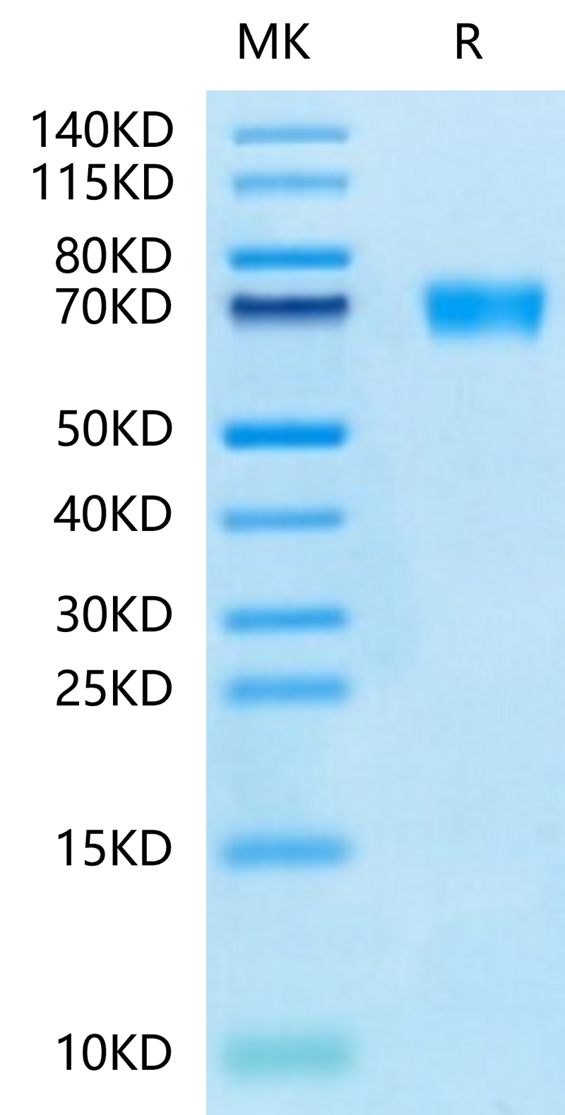 Mouse AXL on Tris-Bis PAGE under reduced condition. The purity is greater than 95%.Recombinant Mouse AXL Protein, Active
