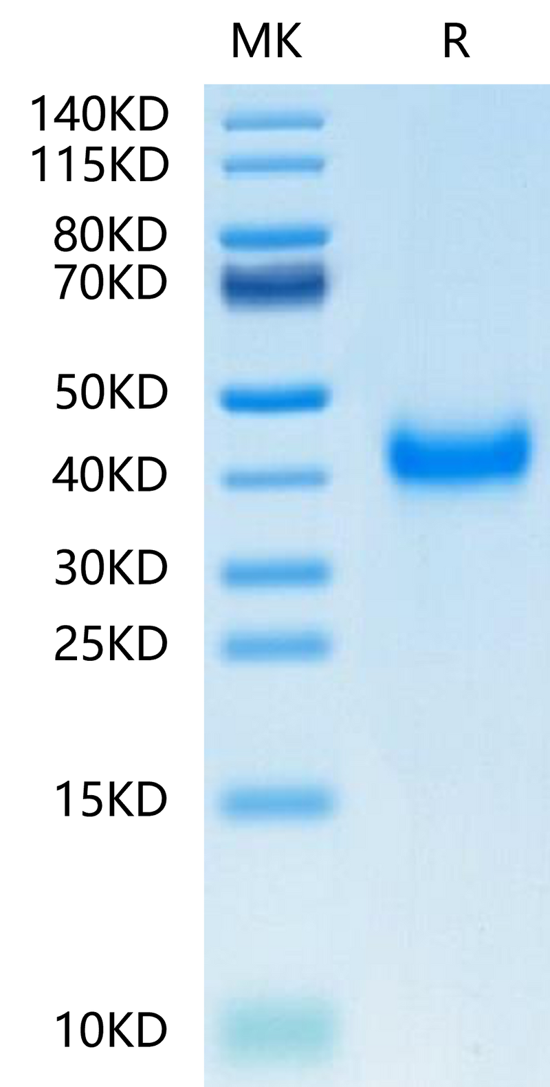 Human CD161 on Tris-Bis PAGE under reduced condition. The purity is greater than 95%.