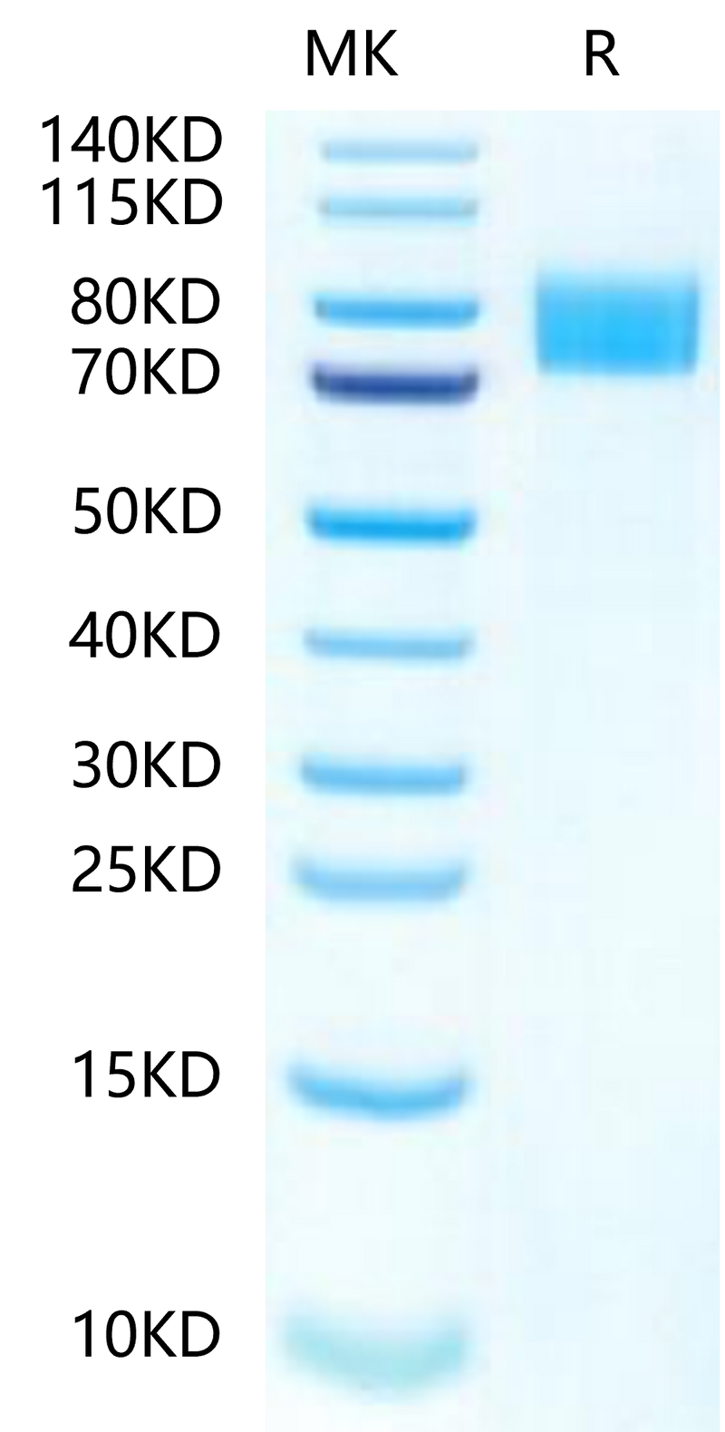 Mouse Siglec-4a on Tris-Bis PAGE under reduced condition. The purity is greater than 95%.