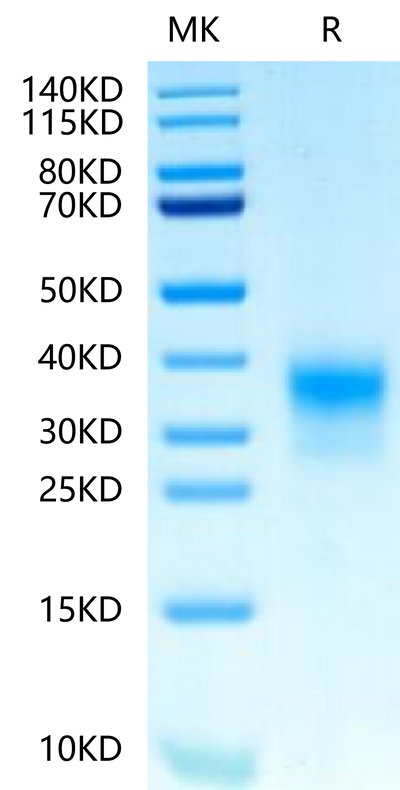 Biotinylated Human Her2 Domain 4 on Tris-Bis PAGE under reduced condition. The purity is greater than 95%.Biotinylated Human Her2/ErbB2 Domain 4 Protein, Active