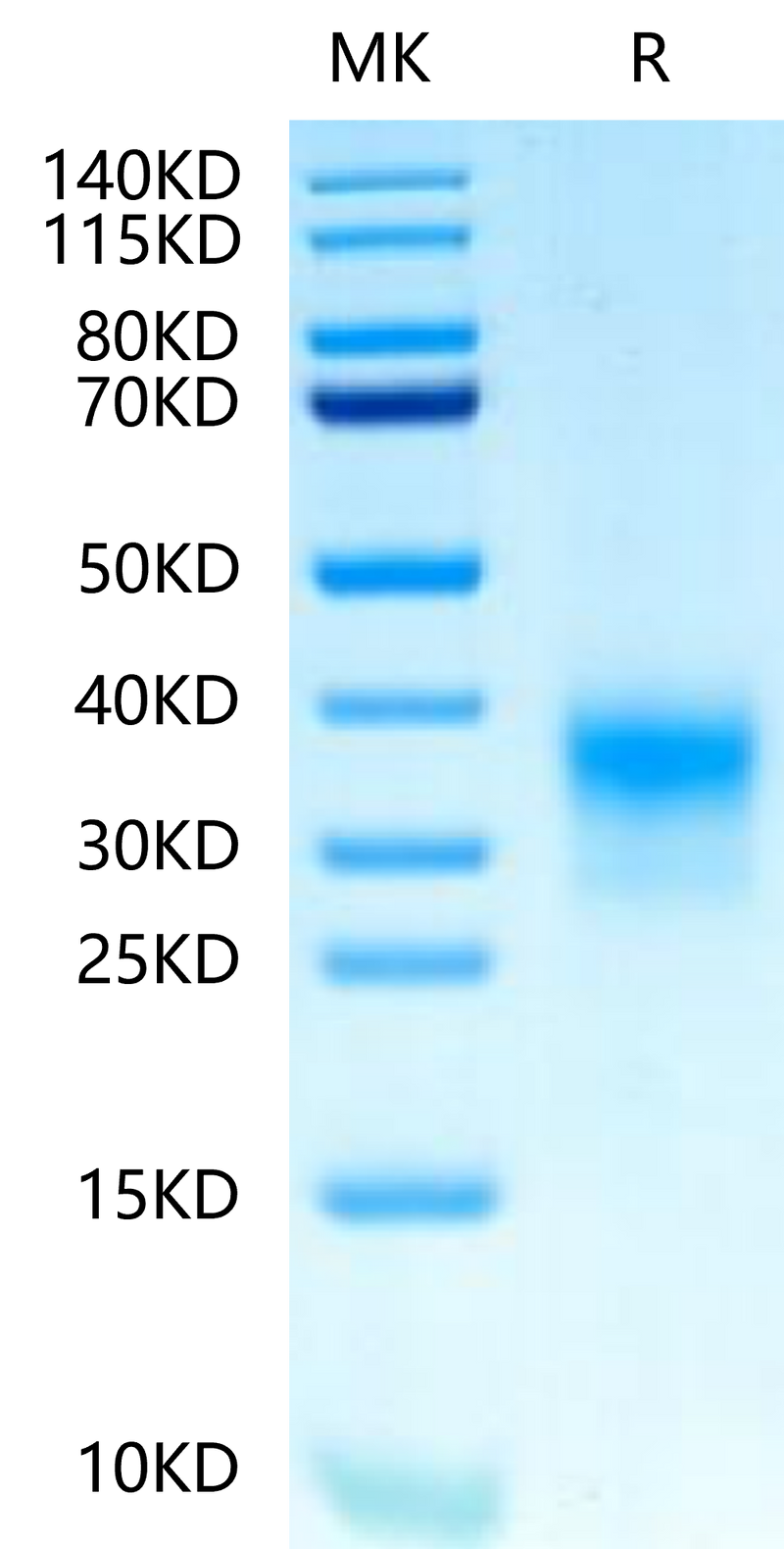 Biotinylated Human Her2 Domain 4 on Tris-Bis PAGE under reduced condition. The purity is greater than 95%.Biotinylated Human Her2/ErbB2 Domain 4 Protein, Active