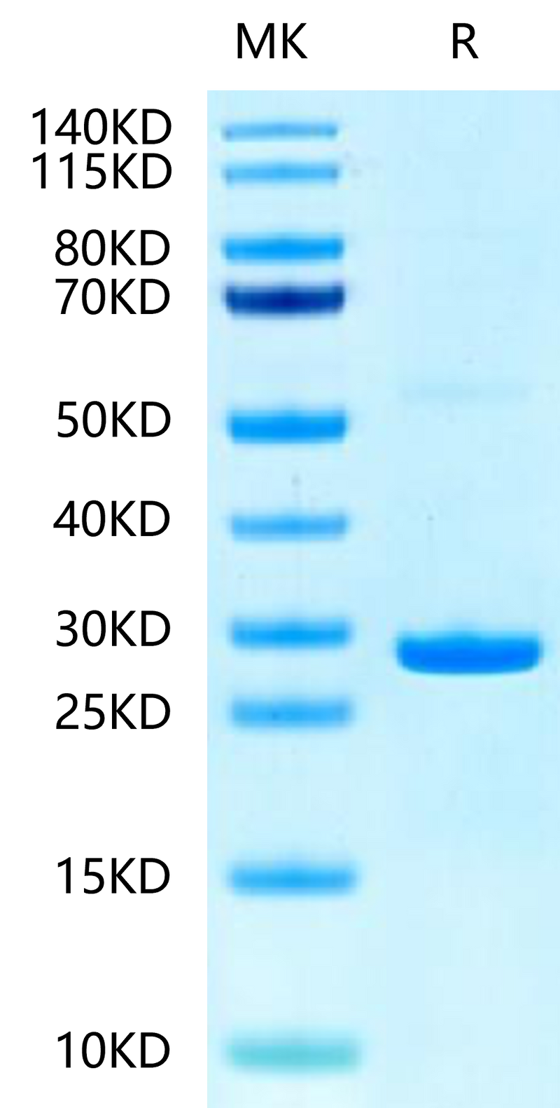 Human Hsp27 on Tris-Bis PAGE under reduced condition. The purity is greater than 95%.Recombinant Human Hsp27/HSPB1-Protein